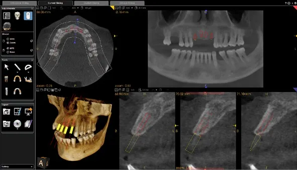 Cone Beam CT images showing multiple views